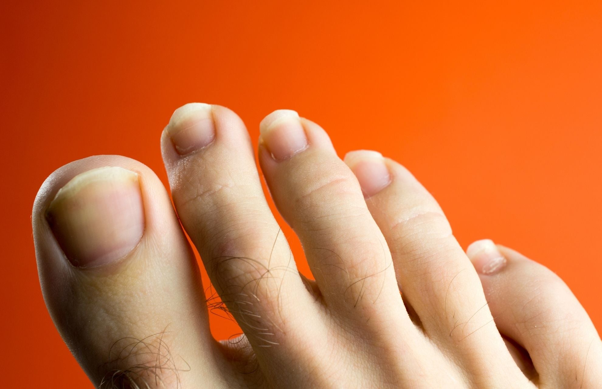 Why Do Toenails Turn Yellow and How to Prevent It Manmade