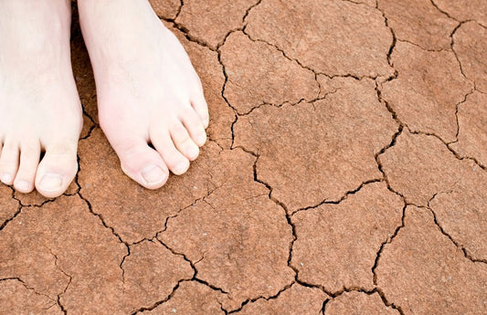 Importance of Dry Feet: Tips to Keep Your Feet Healthy